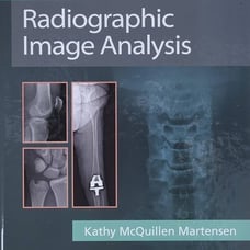 Xray Textbook radiographic image analysis