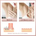IPL Hair Removal