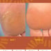 Epoch Sole Solution Foot Treatment (1 TUBE NEW!!)