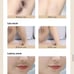 IPL Permanent Hair Removal at Home Solut