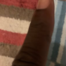 Big finger