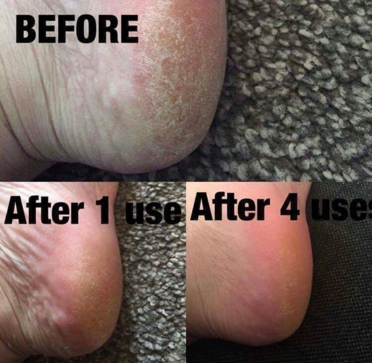 Nu Skin Sole Solution Foot Cream