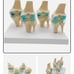 Four-stage Human Pathological Knee Joint Anatomy Model Medical Science Teaching