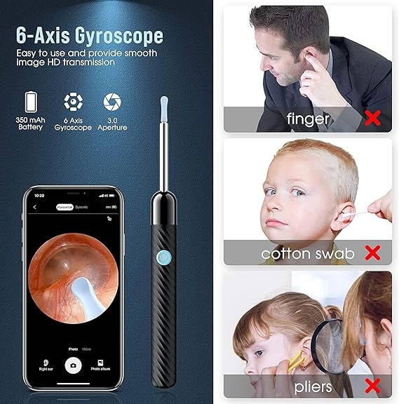 1080P HD Ear Camera: The earwax removal kit is equipped with 6 LED lights and a