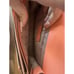 Kate Spade Remi Melon Ball Pineapple Flap Metal Chain Crossbody Purse Bag Coral