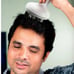 BNIB Eternal Living Hair Scalp Massager with Kneading Massage Nodes