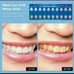 ♡New Teeth Whitening Bundle♡