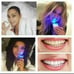 ♡New Teeth Whitening Bundle♡