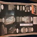 Harley Davidson sportster ironhead chrome hardware set