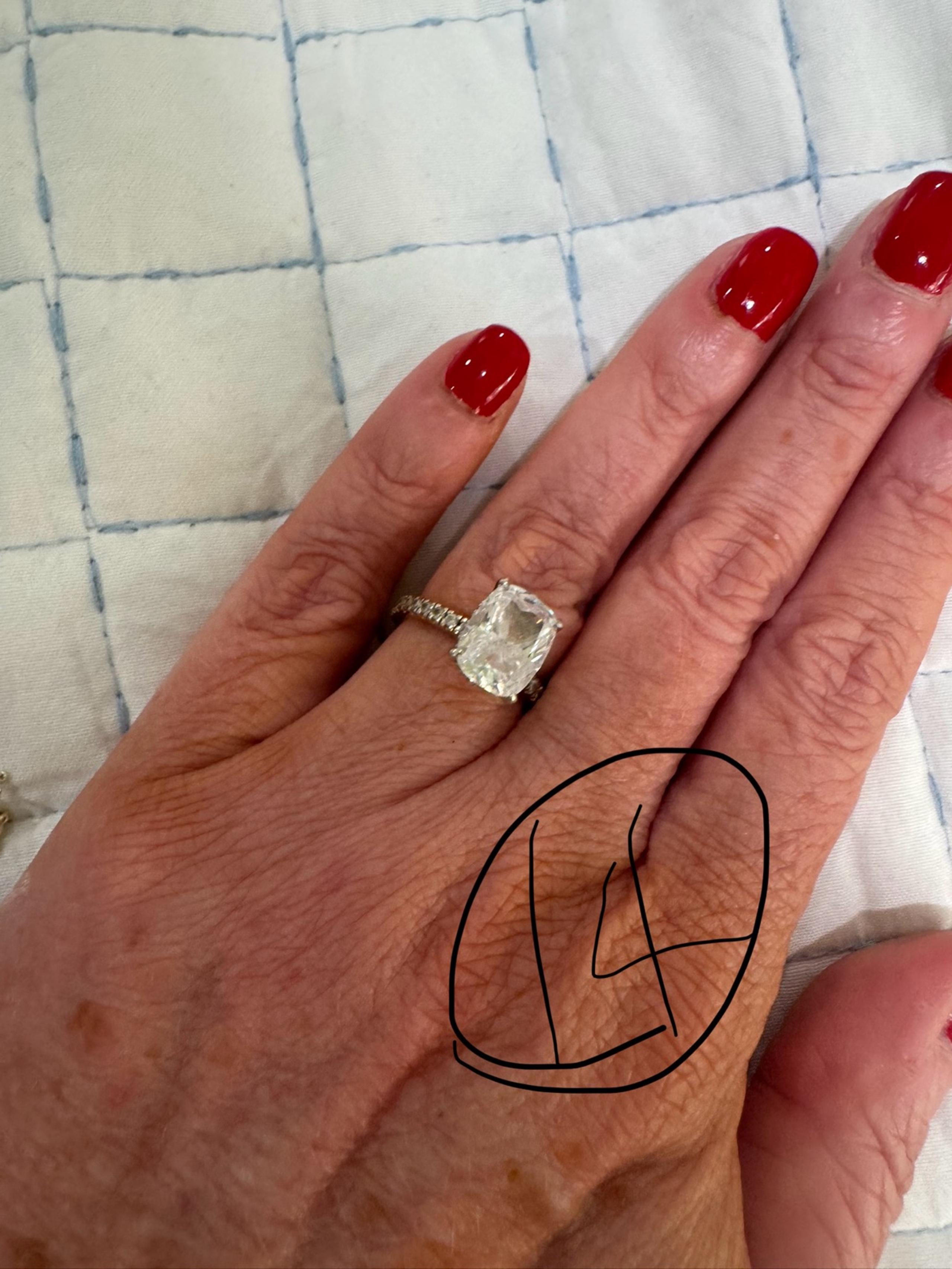 Everly ring