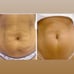 NU SKIN BUNDLE - 4 Products