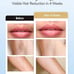 INNZA Laser Hair Removal with Ice Cooling Care Function for Women Permanent,999,