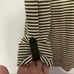 striped buckle button large