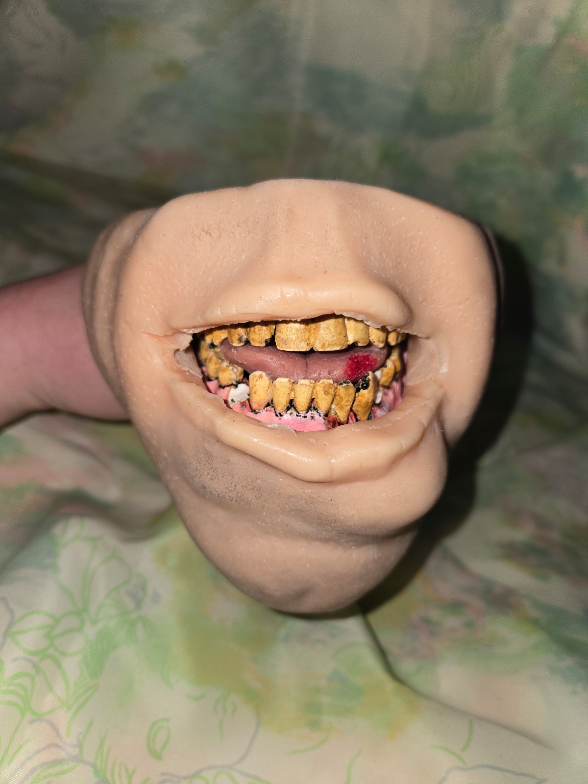 Vintage Dip Lip Realistic Human Mouth Cancer Teeth Display Medical Oddity