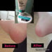 Foot Care