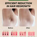At-Home IPL Hair Removal for Women and Men Hair Removal 999,999 Flashes Painless
