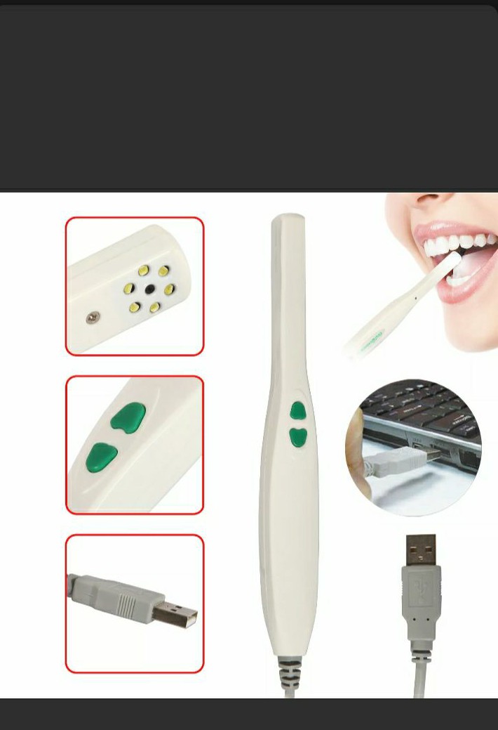 Interoral camera