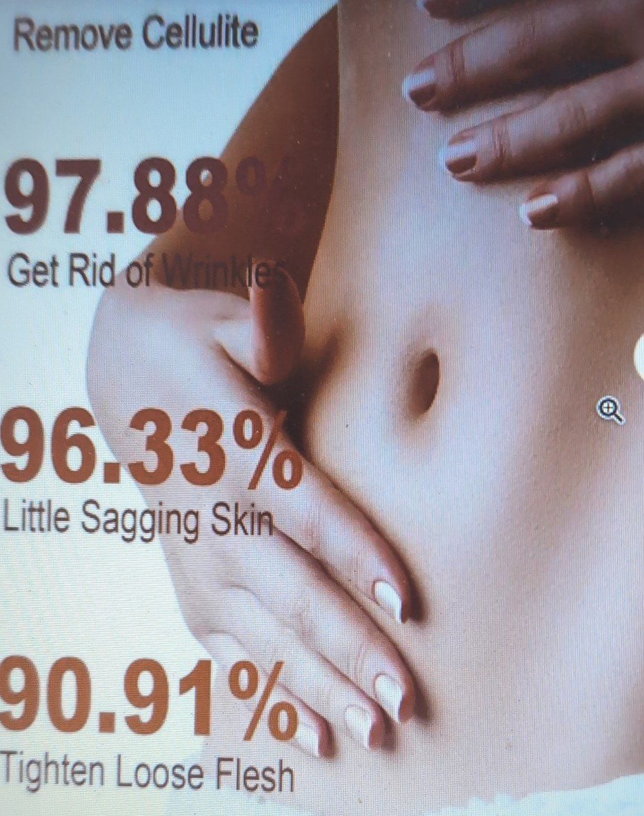 New Belly Wraps Combined With Belly Firming Cream System