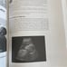 Intellectual Disabilities Across the Lifespan by Michael Hardman and Clifford...