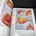 Vintage 1948 - medical The Cuba collection of medical illustrations