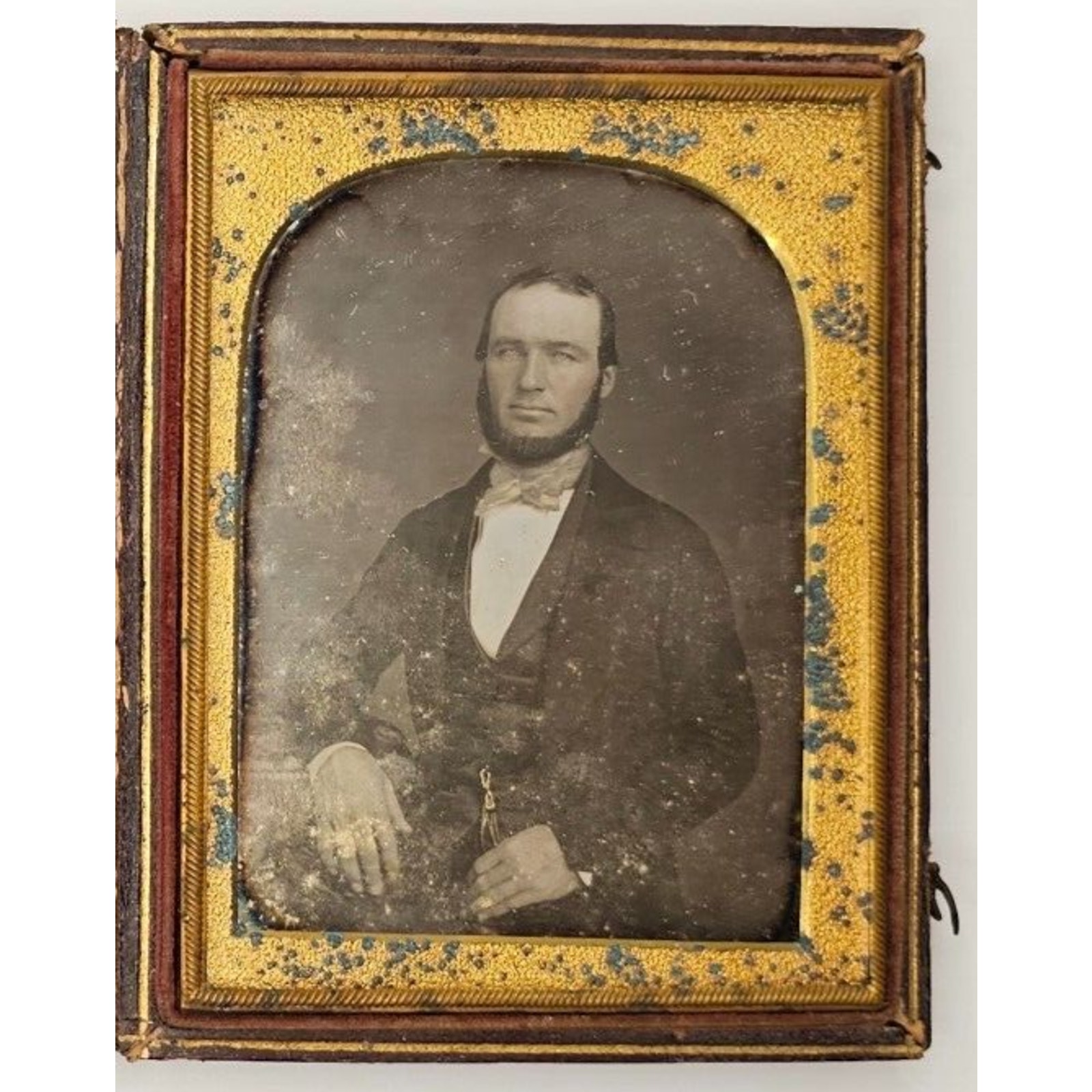 1/4th Plate Daguerreotype Of A Bearded Man In A Full Union Case
