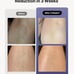 Ulike Laser Hair Remover For Women And Men. Air 3 Ice-cooling IPL Device Purple