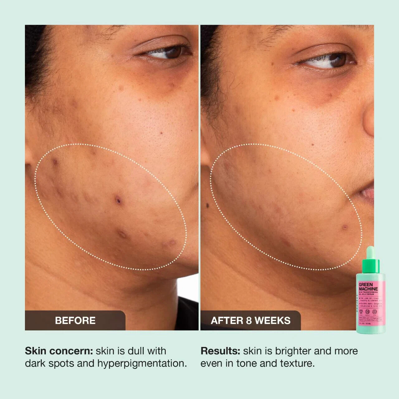 iNNBEAUTY PROJECT Green Machine Vitamin C Dark Spot and Hyperpigmentat ion Serum