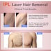 EMPYREUS Painless Professional Permanent Hair Removal Device