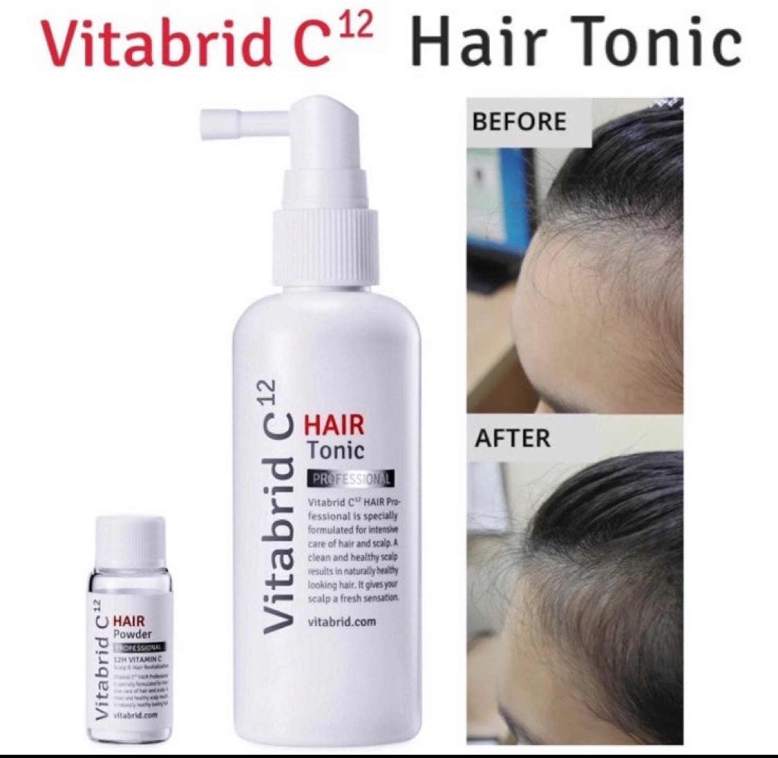 Hair Tonice Set - Vitabrid