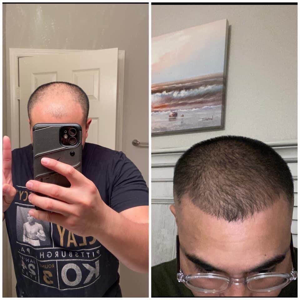Hair and beard growth serum
