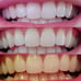 3 tubes Ap24 whitening toothpaste