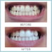 3 tubes Ap24 whitening toothpaste