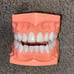 Dental Teeth Model for Patient Education