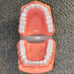 Dental Teeth Model for Patient Education