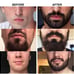 Beard Growth Kit