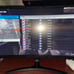 ACER gaming monitor