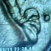 1776-1976 Bicentennial quarter with Filled in D mint mark