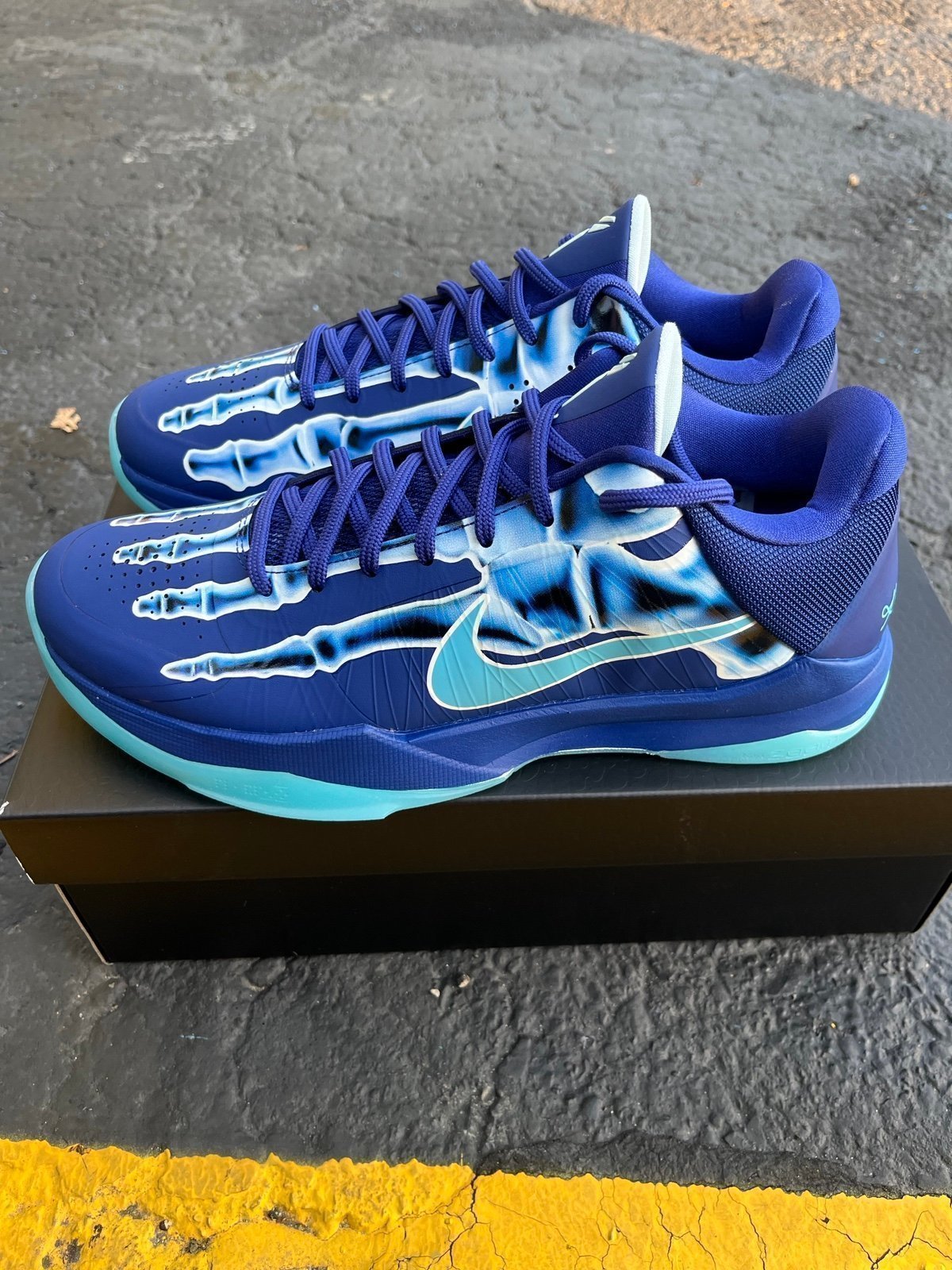 Kobe 5 X-ray